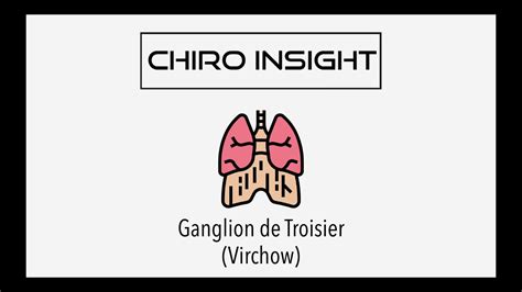 Ganglion De Troisier Palpation Virchows Test Youtube