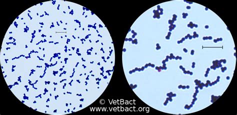 Streptococcus Agalactiae