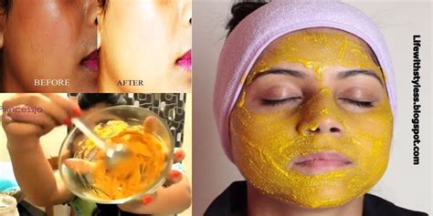 Homemade Face Mask Pack For Brighteningwhitening And Glowing Skin