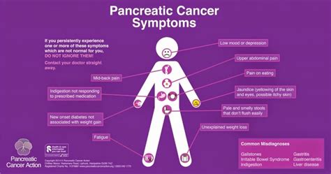 Very Early Symptoms Pancreatic Cancer Bing Images