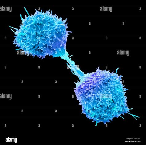 Lymphoma Cancer Cell Coloured Scanning Electron Micrograph Sem Of