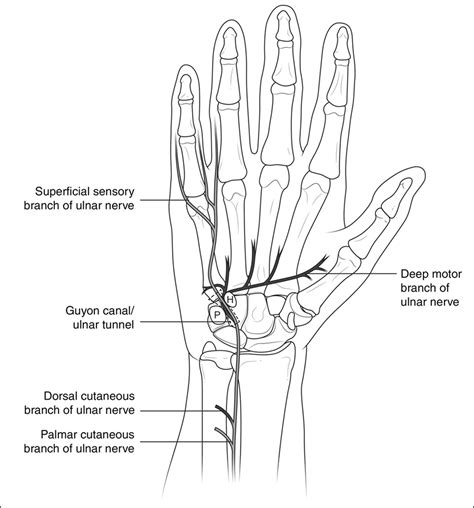Ulnar Nerve Entrapment At The Wrist Jaaos Journal Of The American