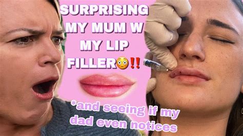 Lip Filler Vlog Mums Reaction Youtube