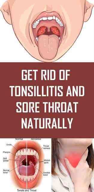 Sore Throat Lymph Nodes Swollen Tonsillectomy Teenagers
