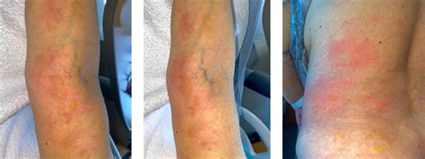 A Patient With Jaundice And A Rash The Bmj