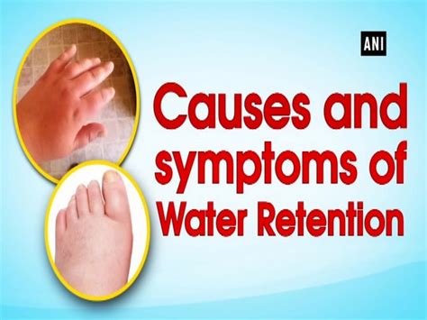 Causes And Symptoms Of Water Retention