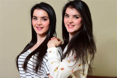 Twin Sisters Who Share Everything Shocked Doctors When Diagnosed With