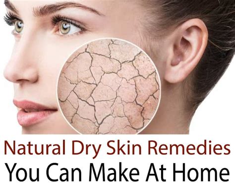 The Best Natural Dry Skin Remedies That You Can Make At Home