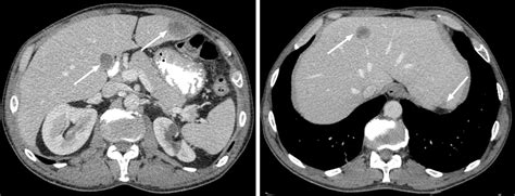 Imaging Evaluation Of The Liver In Oncology Patients A Comparison Of
