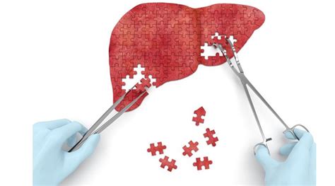 How To Take Care Of Your Liver Testsure