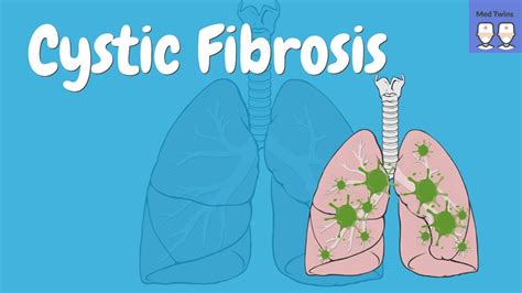 Cystic Fibrosis CFTR Pathophysiology Signs And Symptoms Diagnosis