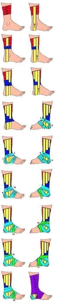 How to wrap a sprained foot with athletic tape. Pin on UT