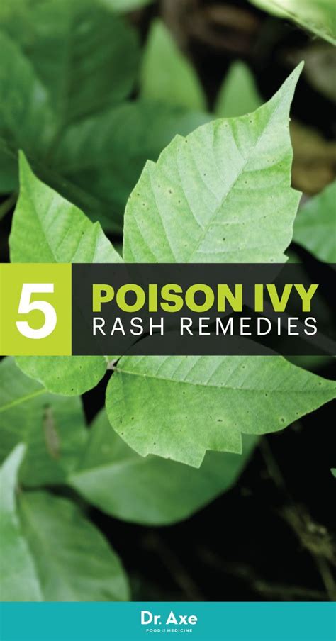 Top 5 Natural Remedies For Poison Ivy Rash Allergyrashremedy Poison