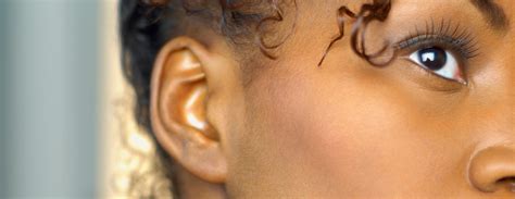Ear Reshaping Conditions And Treatments Ucsf Health
