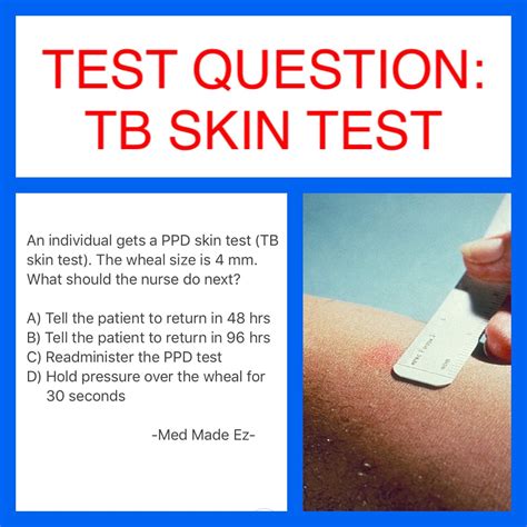 TEST QUESTION TB SKIN TEST Med Made Ez MME Nursing Schools In Nyc