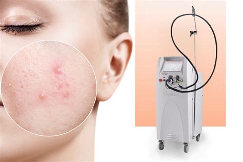 Acnee Skin Laser Clinic