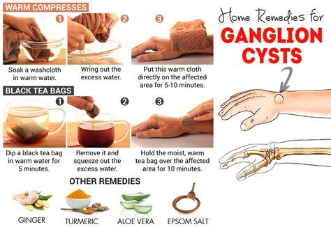 Many people note a large soft bump that can be pushed on a little with some. Home remedies for ganglion cysts - How to treat ganglion ...