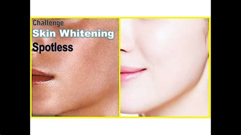 Days Fairness Challenge Skin Whitening Home Remedy Skin Care Tips