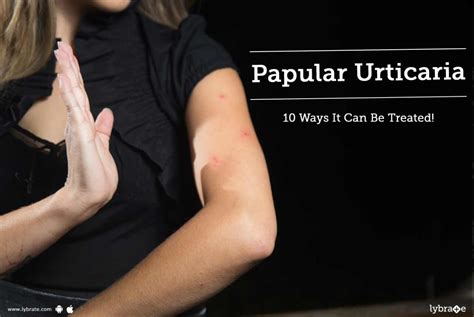 Papular Urticaria 10 Ways It Can Be Treated By Dr Sonal Chavan