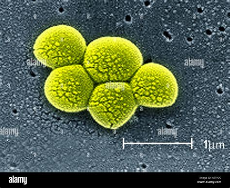 Scanning Electron Microscope Image Of Mrsa Staphylococcus Bacteria