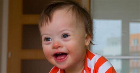 What kind of society do you want to live in?: Down's syndrome births drop 30% in hospitals where new ...