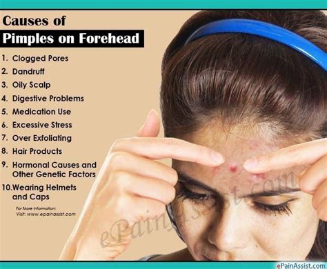 Causes Of Pimples On Forehead Pimplesundertheskin Pimplesextraction