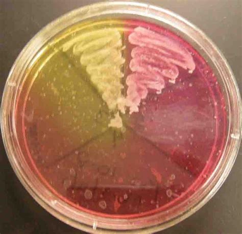 Mannitol Salt Agar Microbiology Images Photographs From Science Prof