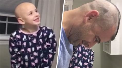 Dad Shaved Head To Support Daughter With Alopecia
