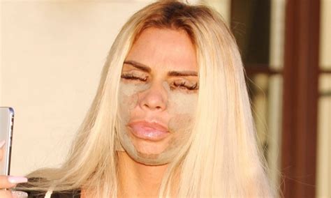Katie Price Can Hardly Open Her Eyes As She Appears In Face Bandages After Latest Surgery