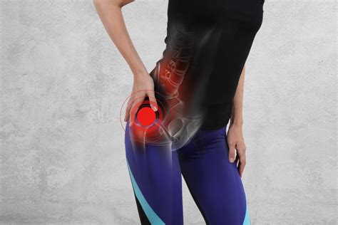Trochanteric Bursitis You Dont Have To Live With Hip Pain