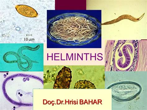 Helminths Parasitic Worm And How They Affect You