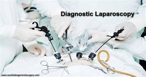 Diagnostic Laparoscopy Procedure And Recovery Southlake General Surgery