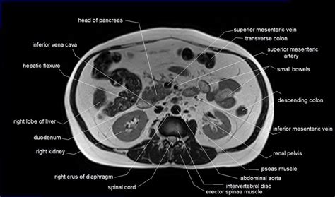 Abdominal Anatomy Chart Female Anatomy Of The Female Pelvis Ct Mri