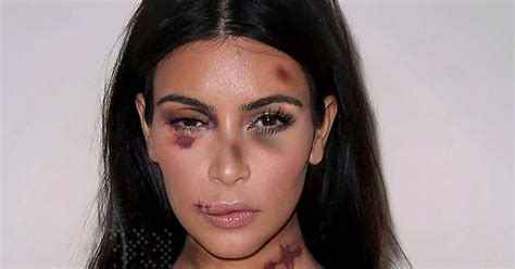 Kim Kardashian ‘bruised And Battered And Left With Black Eyes In Shocking New Domestic Violence