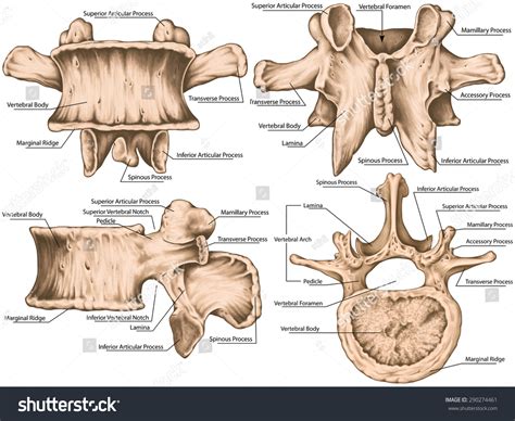 Lumbar Vertebrae Accessory Process