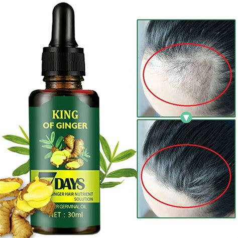 30ml regrow 7 day ginger hair germinal hair growth serum loss treatment oil natural extract anti