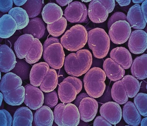 Sorry Folks Antibiotic Resistant Gonorrhea Is Getting Worse The Washington Post
