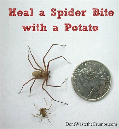 Best 25 Brown Recluse Bite Stages Ideas On Pinterest Brown Recluse