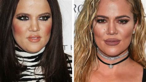 Khloe Kardashian Before And Now Plastic Surgery