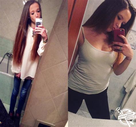 Meet The Anorexic Girl Who Made An Incredible Recovery After Her Weight Plummeted To Over Five