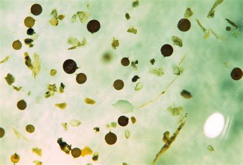 Germinating Fungal Spores Stock Image B2501742 Science Photo Library