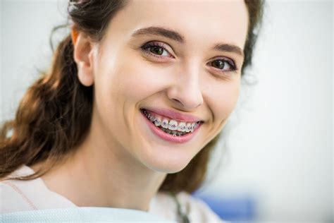 5 Things To Know When Getting Braces As An Adult Miosuperhealth
