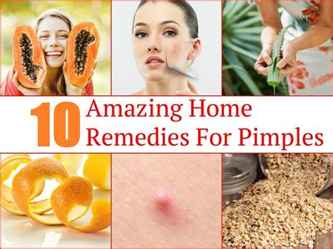 10 Amazing Home Remedies For Pimples School Of Life