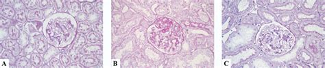 Renal Histology Of Rat Kidney Tissue Sham Normal Glomerulus A Nx