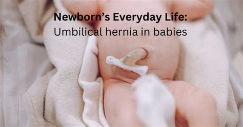 2024 Newborns Everyday Life Umbilical Hernia In Babies Part 3