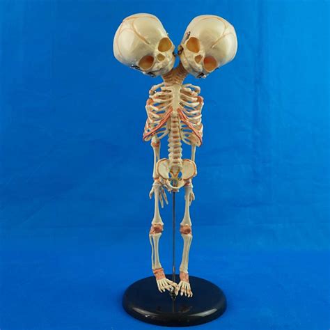 131537cm Human New Double Head Baby Anatomy Skull Skeleton Anatomical