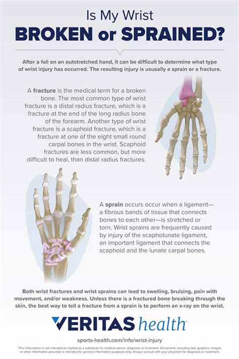 Is My Wrist Broken Or Sprained Infographic Sports Health