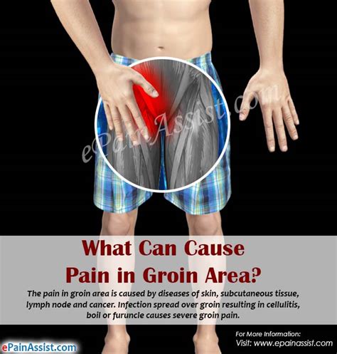 Five Doubts About Muscle Spasm In Left Groin Area You Should Clarify