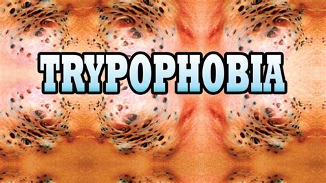 What Is Trypophobia Causes Symptoms And Treatment Rezfoods Resep Masakan Indonesia