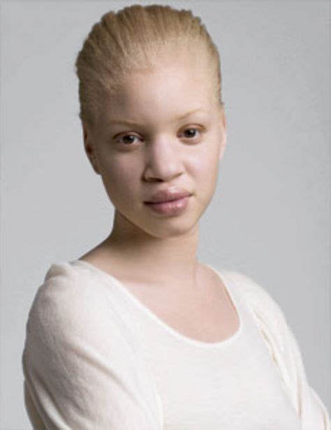 387 Best Venus Images In 2019 Venus Beautiful Freckles Albino Model